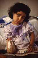 Child victim of a cluster bomb
Berbir Hospital For Time Magazine